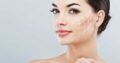 Skin Brightening Treatments North Vancouver