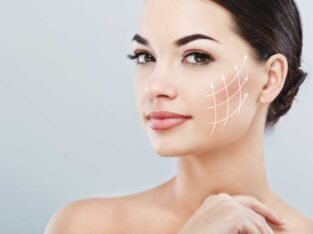 Skin Brightening Treatments North Vancouver