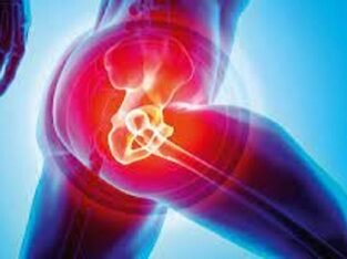 Introducing the best clinic for Hip Replacement in Jaipur