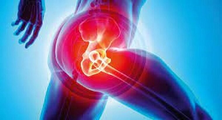 Introducing the best clinic for Hip Replacement in Jaipur