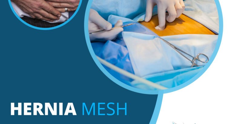 HERNIA MESH FAILURES GENERATE RECALLS, LAWSUITS