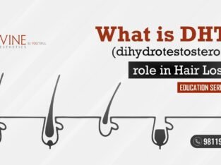 What is DHT? – (Dihydrotestosterone) & What Does it Do? Role of DHT in Hair Loss?