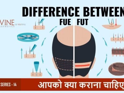 What is Different between FUE & FUT Hair Transplant?