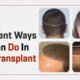 Different Ways we can do in Hair Transplant